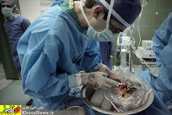 اهداء اعضاي بيمار مرگ مغزي در اهواز