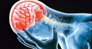 روش‌ درمانی‌ جدید برای‌ بهبود ناتوانی‌ جسمی ناشی‌ از سکته‌ مغزی