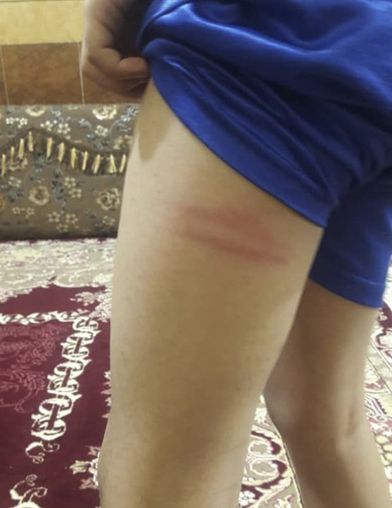 جزئیات تنبیه بدنی دانش‌آموزان یکی از مدارس بندرماهشهر توسط ناظم